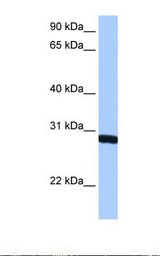 SMN1 Antibody - HepG2 cell lysate. Antibody concentration: 0.5 ug/ml. Gel concentration: 12%.  This image was taken for the unconjugated form of this product. Other forms have not been tested.