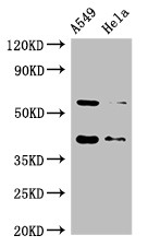 SMN1 Antibody - Positive WB detected in:A549 whole cell lysate,Hela whole cell lysate;All lanes:SMN1 antibody at 2?g/ml;Secondary;Goat polyclonal to rabbit IgG at 1/50000 dilution;Predicted band size: 32,29,31,28 KDa;Observed band size: 40,60 KDa;