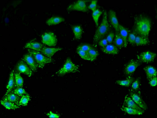 SMN1 Antibody - Immunofluorescent analysis of HepG2 cells using SMN1 Antibody at a dilution of 1:100 and Alexa Fluor 488-congugated AffiniPure Goat Anti-Rabbit IgG(H+L)