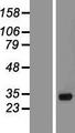 SMN1 Protein - Western validation with an anti-DDK antibody * L: Control HEK293 lysate R: Over-expression lysate