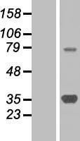 SMN1 Protein - Western validation with an anti-DDK antibody * L: Control HEK293 lysate R: Over-expression lysate