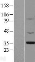 SMN1 Protein - Western validation with an anti-DDK antibody * L: Control HEK293 lysate R: Over-expression lysate