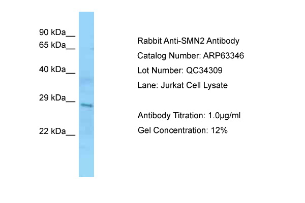 SMN1/SMN2 Antibody -  This image was taken for the unconjugated form of this product. Other forms have not been tested.