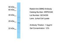 SMN1/SMN2 Antibody -  This image was taken for the unconjugated form of this product. Other forms have not been tested.