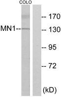 SMN1/SMN2 Antibody - Western blot analysis of extracts from COLO cells, using MN1 antibody.