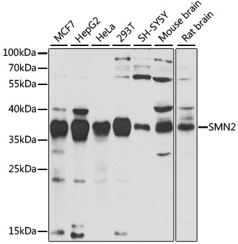 SMN2 Antibody - Western blot analysis of extracts of various cell lines, using SMN2 antibody at 1:1000 dilution. The secondary antibody used was an HRP Goat Anti-Rabbit IgG (H+L) at 1:10000 dilution. Lysates were loaded 25ug per lane and 3% nonfat dry milk in TBST was used for blocking. An ECL Kit was used for detection and the exposure time was 30s.