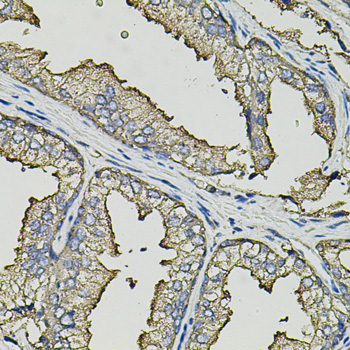 SMN2 Antibody - Immunohistochemistry of paraffin-embedded human prostate using SMN2 antibody(40x lens).