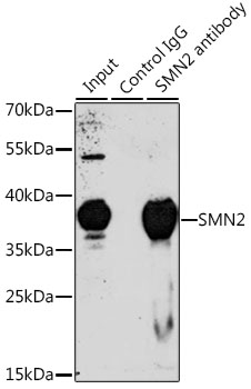 SMN2 Antibody - Immunoprecipitation analysis of 200ug extracts of 293T cells, using 3 ug SMN2 antibody. Western blot was performed from the immunoprecipitate using SMN2 antibodyat a dilition of 1:1000.