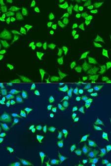 SMN2 Antibody - Immunofluorescence analysis of U2OS cells using SMN2 antibody at dilution of 1:100. Blue: DAPI for nuclear staining.