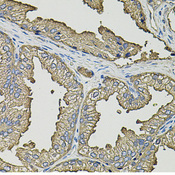 SMN2 Antibody - Immunohistochemistry of paraffin-embedded human prostate using SMN2 antibody (40x lens).