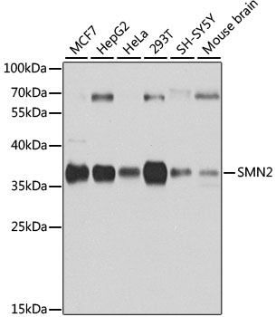 SMN2 Antibody - Western blot analysis of extracts of various cell lines, using SMN2 antibody at 1:1000 dilution. The secondary antibody used was an HRP Goat Anti-Rabbit IgG (H+L) at 1:10000 dilution. Lysates were loaded 25ug per lane and 3% nonfat dry milk in TBST was used for blocking. An ECL Kit was used for detection and the exposure time was 10s.