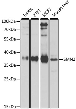 SMN2 Antibody - Western blot analysis of extracts of various cell lines, using SMN2 antibody at 1:1000 dilution. The secondary antibody used was an HRP Goat Anti-Rabbit IgG (H+L) at 1:10000 dilution. Lysates were loaded 25ug per lane and 3% nonfat dry milk in TBST was used for blocking. An ECL Kit was used for detection and the exposure time was 30s.