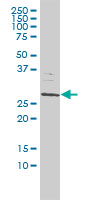 SMNDC1 Antibody - SMNDC1 monoclonal antibody (M01), clone 2B9 Western blot of SMNDC1 expression in Jurkat.