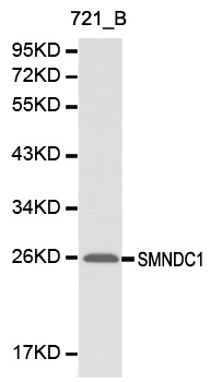 SMNDC1 Antibody - Western blot analysis of 721-B cell lysate.