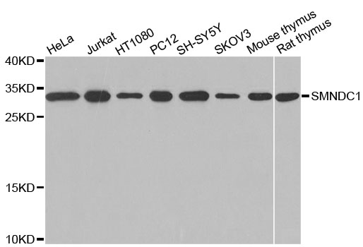 SMNDC1 Antibody - Western blot analysis of extracts of various cell lines, using SMNDC1 antibody at 1:1000 dilution. The secondary antibody used was an HRP Goat Anti-Rabbit IgG (H+L) at 1:10000 dilution. Lysates were loaded 25ug per lane and 3% nonfat dry milk in TBST was used for blocking. An ECL Kit was used for detection and the exposure time was 10s.