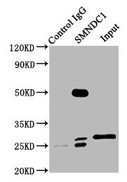 SMNDC1 Antibody - Immunoprecipitating SMNDC1 in Hela whole cell lysate Lane 1: Rabbit control IgG (1µg) instead of SMNDC1 Antibody in Hela whole cell lysate.For western blotting, a HRP-conjugated Protein G antibody was used as the secondary antibody (1/2000) Lane 2: SMNDC1 Antibody (6µg) + Hela whole cell lysate (500µg) Lane 3: Hela whole cell lysate (10µg)