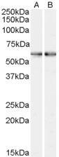 SMO / Smoothened Antibody - A) Goat Anti-SMO (C Terminus) Antibody and B) Goat Anti-SMO (internal) Antibody (0.3µg/ml) staining of Human Bone Marrow lysate (35µg protein in RIPA buffer). Primary incubation was 1 hour. Detected by chemiluminescencence.