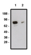 SMO / Smoothened Antibody - Western blot of SMO antibody (LS-C140596P) on human brain lysate. Lysate loaded at 15 ug/lane. Antibody used at 10 ug/ml (1) and 5 ug/ml (2) dilution. Secondary antibody, mouse anti-rabbit-HRP, used at 1:150K dilution.