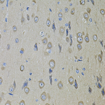 SMO / Smoothened Antibody - Immunohistochemistry of paraffin-embedded rat brain tissue.