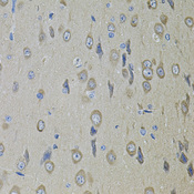 SMO / Smoothened Antibody - Immunohistochemistry of paraffin-embedded rat brain tissue.