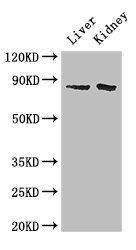 SMO / Smoothened Antibody - Positive WB detected in:Mouse liver tissue,Mouse kidney tissue;All lanes: SMO antibody at 2ug/ml;Secondary;Goat polyclonal to rabbit IgG at 1/50000 dilution;Predicted band size: 87 kDa;Observed band size: 87 kDa;