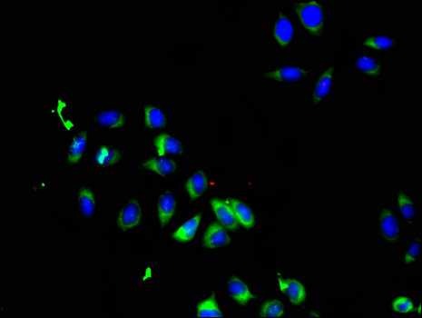 SMO / Smoothened Antibody - Immunofluorescent analysis of A549 cells using SMO Antibody at a dilution of 1:100 and Alexa Fluor 488-congugated AffiniPure Goat Anti-Rabbit IgG(H+L)