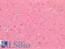 SMO / Smoothened Antibody - Human Brain, Cortex: Formalin-Fixed, Paraffin-Embedded (FFPE)