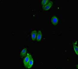 SMOC1 Antibody - Immunofluorescent analysis of HepG-2 cells diluted at 1:100 and Alexa Fluor 488-congugated AffiniPure Goat Anti-Rabbit IgG(H+L)