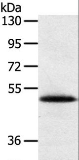 SMOC2 Antibody - Western blot analysis of Human placenta tissue, using SMOC2 Polyclonal Antibody at dilution of 1:250.