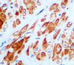 Smoothelin Antibody - IHC of Smoothelin on FFPE Uterus tissue. This image was taken for the unmodified form of this product. Other forms have not been tested.