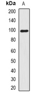 Smoothelin Antibody - Western blot analysis of Smoothelin expression in A375 (A) whole cell lysates.
