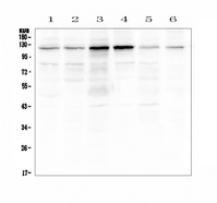 Smoothelin Antibody - Western blot analysis of Smoothelin using anti-Smoothelin antibody. Electrophoresis was performed on a 5-20% SDS-PAGE gel at 70V (Stacking gel) / 90V (Resolving gel) for 2-3 hours. The sample well of each lane was loaded with 50ug of sample under reducing conditions. Lane 1: human Hela whole cell lysates,Lane 2: human COLO-320 whole cell lysates,Lane 3: human SW620 whole cell lysates,Lane 4: human K562 whole cell lysates,Lane 5: human A375 whole cell lysates,Lane 6: mouse smooth muscle tissue lysates. After Electrophoresis, proteins were transferred to a Nitrocellulose membrane at 150mA for 50-90 minutes. Blocked the membrane with 5% Non-fat Milk/ TBS for 1.5 hour at RT. The membrane was incubated with rabbit anti-Smoothelin antigen affinity purified polyclonal antibody at 0.5 ?g/mL overnight at 4?C, then washed with TBS-0.1% Tween 3 times with 5 minutes each and probed with a goat anti-rabbit IgG-HRP secondary antibody at a dilution of 1:10000 for 1.5 hour at RT. The signal is developed using an Enhanced Chemiluminescent detection (ECL) kit with Tanon 5200 system. A specific band was detected for Smoothelin at approximately 120KD. The expected band size for Smoothelin is at 99KD.
