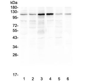 Smoothelin Antibody - Western blot testing of human 1) HeLa, 2) COLO-320, 3) SW620, 4) K562, 5) A375 and 6) mouse smooth muscle (intestine) lysate with Smoothelin antibody at 0.5ug/ml. Predicted molecular weight ~99 kDa but commonly observed at ~110 kDa (long form).