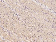 Smoothelin Antibody - Immunochemical staining of human SMTN in human smooth muscle with rabbit polyclonal antibody at 1:100 dilution, formalin-fixed paraffin embedded sections.