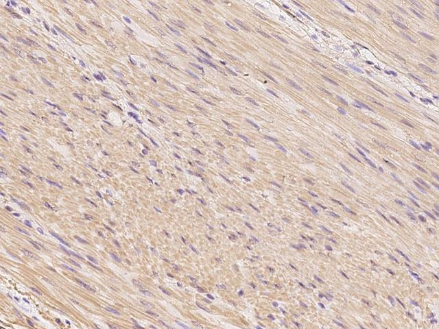 Smoothelin Antibody - Immunochemical staining of human SMTN in human smooth muscle with rabbit polyclonal antibody at 1:100 dilution, formalin-fixed paraffin embedded sections.