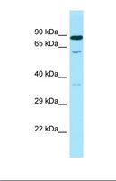 SMOX / PAO Antibody - Western blot of Human Fetal Kidney. SMOX antibody dilution 1.0 ug/ml.  This image was taken for the unconjugated form of this product. Other forms have not been tested.