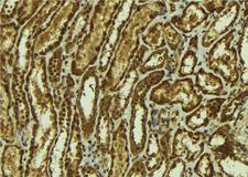 SMOX / PAO Antibody - 1:100 staining mouse kidney tissue by IHC-P. The sample was formaldehyde fixed and a heat mediated antigen retrieval step in citrate buffer was performed. The sample was then blocked and incubated with the antibody for 1.5 hours at 22°C. An HRP conjugated goat anti-rabbit antibody was used as the secondary.