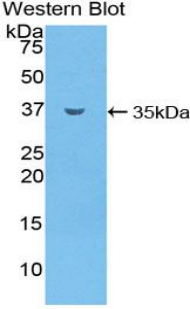 SMPD1 / Acid Sphingomyelinase Antibody - Western blot of recombinant SMPD1 / Acid Sphingomyelinase.  This image was taken for the unconjugated form of this product. Other forms have not been tested.