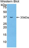 SMPD1 / Acid Sphingomyelinase Antibody - Western blot of recombinant SMPD1 / Acid Sphingomyelinase.  This image was taken for the unconjugated form of this product. Other forms have not been tested.