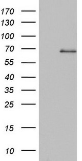 SMPD1 / Acid Sphingomyelinase Antibody - HEK293T cells were transfected with the pCMV6-ENTRY control (Left lane) or pCMV6-ENTRY SMPD1 (Right lane) cDNA for 48 hrs and lysed. Equivalent amounts of cell lysates (5 ug per lane) were separated by SDS-PAGE and immunoblotted with anti-SMPD1.