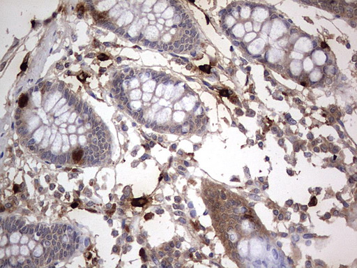 SMPD1 / Acid Sphingomyelinase Antibody - IHC of paraffin-embedded Human colon tissue using anti-SMPD1 mouse monoclonal antibody. (Heat-induced epitope retrieval by 1 mM EDTA in 10mM Tris, pH8.5, 120°C for 3min).