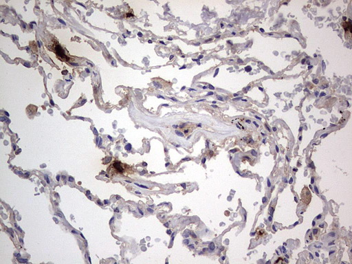 SMPD1 / Acid Sphingomyelinase Antibody - IHC of paraffin-embedded Human lung tissue using anti-SMPD1 mouse monoclonal antibody. (Heat-induced epitope retrieval by 1 mM EDTA in 10mM Tris, pH8.5, 120°C for 3min).
