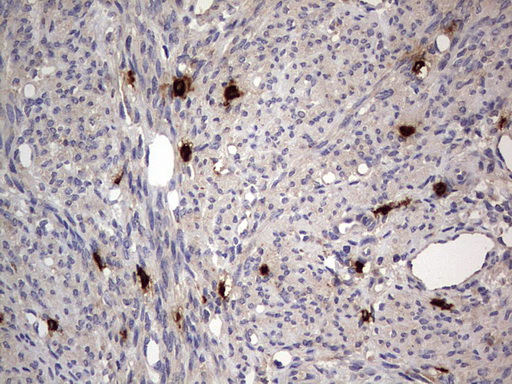 SMPD1 / Acid Sphingomyelinase Antibody - IHC of paraffin-embedded Human endometrium tissue using anti-SMPD1 mouse monoclonal antibody. (Heat-induced epitope retrieval by 1 mM EDTA in 10mM Tris, pH8.5, 120°C for 3min).