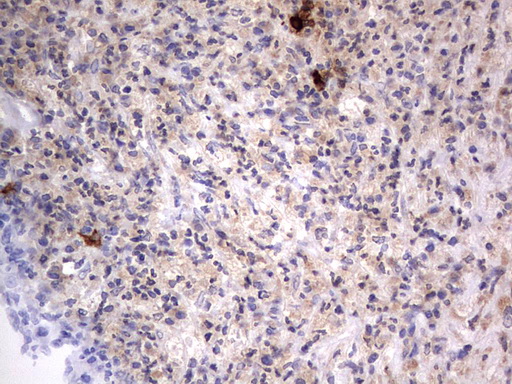 SMPD1 / Acid Sphingomyelinase Antibody - IHC of paraffin-embedded Human lymph node tissue using anti-SMPD1 mouse monoclonal antibody. (Heat-induced epitope retrieval by 1 mM EDTA in 10mM Tris, pH8.5, 120°C for 3min).