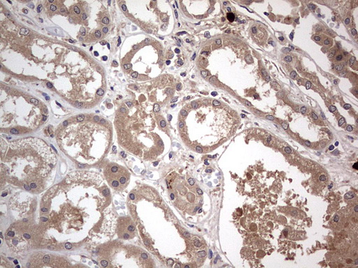SMPD1 / Acid Sphingomyelinase Antibody - IHC of paraffin-embedded Human Kidney tissue using anti-SMPD1 mouse monoclonal antibody. (Heat-induced epitope retrieval by 1 mM EDTA in 10mM Tris, pH8.5, 120°C for 3min).