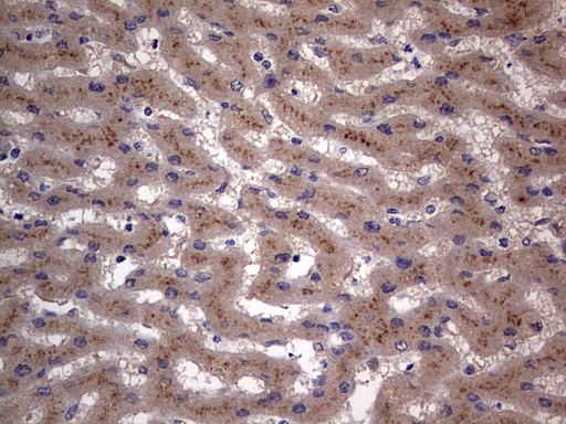 SMPD1 / Acid Sphingomyelinase Antibody - IHC of paraffin-embedded Human liver tissue using anti-SMPD1 mouse monoclonal antibody. (Heat-induced epitope retrieval by 1 mM EDTA in 10mM Tris, pH8.5, 120°C for 3min).
