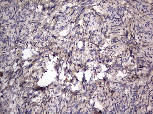 SMPD1 / Acid Sphingomyelinase Antibody - IHC of paraffin-embedded Human Ovary tissue using anti-SMPD1 mouse monoclonal antibody. (Heat-induced epitope retrieval by 1 mM EDTA in 10mM Tris, pH8.5, 120°C for 3min).
