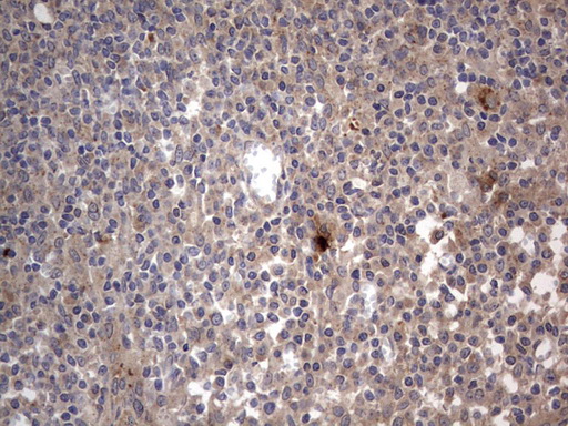 SMPD1 / Acid Sphingomyelinase Antibody - IHC of paraffin-embedded Human tonsil using anti-SMPD1 mouse monoclonal antibody. (Heat-induced epitope retrieval by 1 mM EDTA in 10mM Tris, pH8.5, 120°C for 3min).