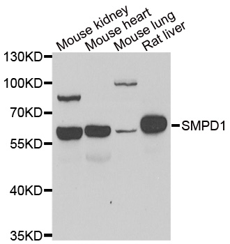 SMPD1 / Acid Sphingomyelinase Antibody - Western blot analysis of extracts of various cell lines, using SMPD1 antibody.