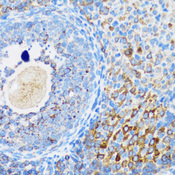 SMPD1 / Acid Sphingomyelinase Antibody - Immunohistochemistry of paraffin-embedded rat ovary tissue.